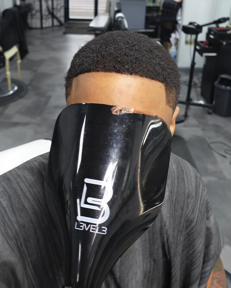 hairline-repair-home